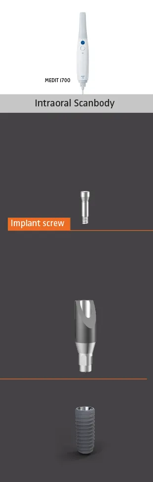 Implantatprothetik übersicht Intraoral Scanbody